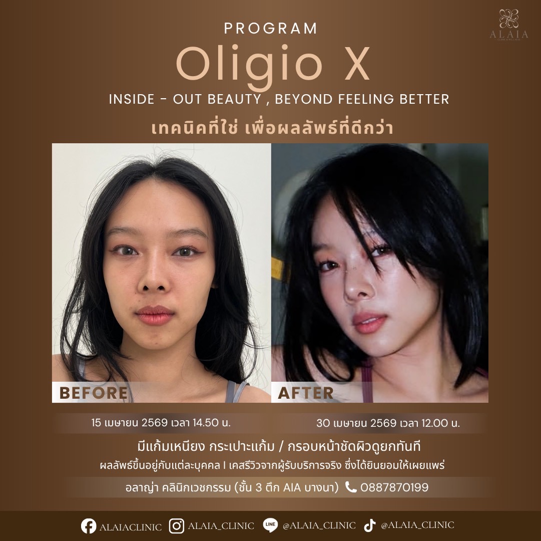 Oligio X Real Result 5